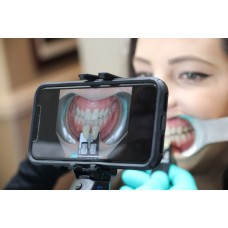 ShadeWave Mobile Dentist